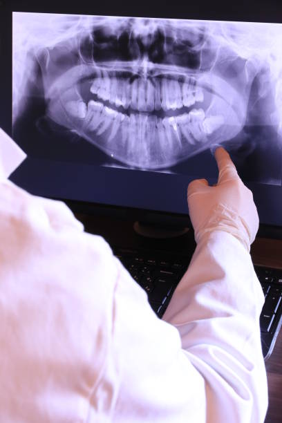 Best Broken or Cracked Tooth Emergency Dentist in Lakewood Park, TN