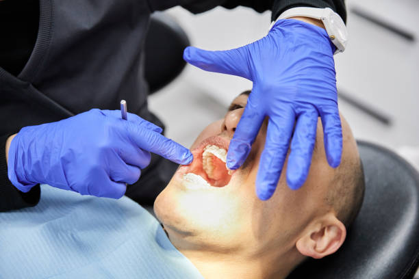 Best Emergency Dentist for Lost Fillings or Crowns in Lakewood Park, TN