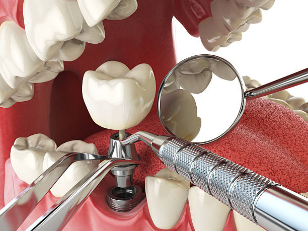 Best Urgent Dental Care for Toothache in Lakewood Park, TN